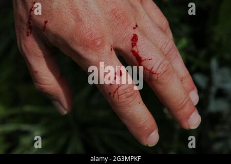 Die Hand des Mannes wurde von einer Katze im Garten frisch zerkratzt. Frisches Blut kommt aus der Hautschicht. Spritzer von Bluttropfen auf einer weißen Blume Stockfoto