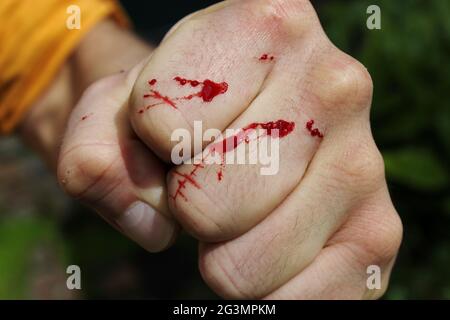 Die Hand des Mannes wurde von einer Katze im Garten frisch zerkratzt. Frisches Blut kommt aus der Hautschicht. Spritzer von Bluttropfen auf einer weißen Blume Stockfoto