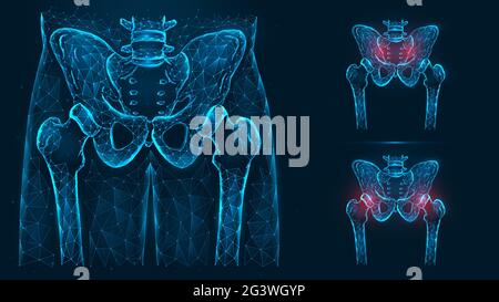 Knochen des Beckens und der Hüfte, menschliche Anatomie. Becken- und Hüftverletzungen. Röntgenaufnahme des Hüftgelenks aus Linien und Punkten, die auf b isoliert sind Stockfoto