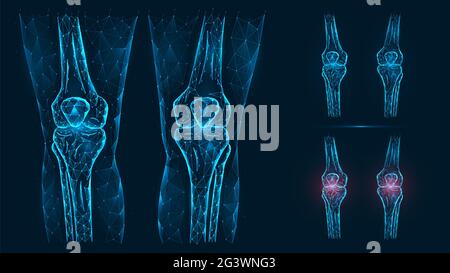 Abstrakte polygonale Illustration der menschlichen Knieanatomie. Krankheit, Schmerzen und Entzündungen der Kniegelenke isoliert auf blauem Rückengr Stockfoto