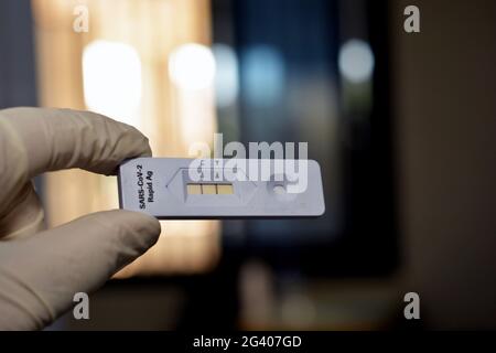 Ein medizinisches Personal zeigt ein positives Ergebnis des SARS-COV-2 Rapid AG-Tests, eines positiven Covid-19-Corona-Virus-Tests vor einem verschwommenen Hintergrund, einer neuartigen Pandemie c Stockfoto