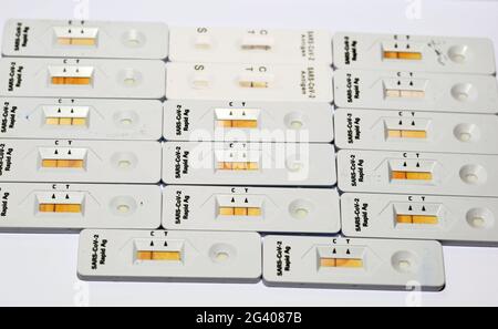 Erfassung positiver und negativer Ergebnisse des SARS-CoV-2 Rapid Antigen AG-Tests mit Nasenabstrich, positiver und negativer Covid-19-Coronavirus-Test Stockfoto