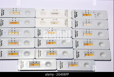 Erfassung positiver und negativer Ergebnisse des SARS-CoV-2 Rapid Antigen AG-Tests mit Nasenabstrich, positiver und negativer Covid-19-Coronavirus-Test Stockfoto