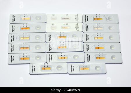 Erfassung positiver und negativer Ergebnisse des SARS-CoV-2 Rapid Antigen AG-Tests mit Nasenabstrich, positiver und negativer Covid-19-Coronavirus-Test Stockfoto