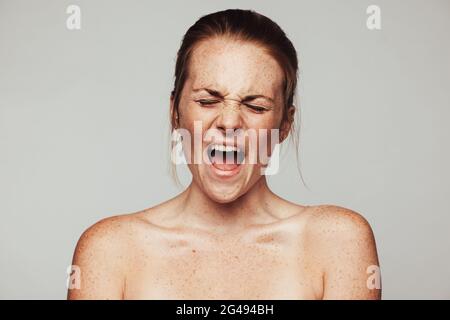Nahaufnahme einer frustrierten Frau mit Sommersprossen am Körper. Porträt einer Frau, die Unmut und Frustration ausdrückt. Stockfoto