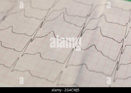 Gedrucktes Kardiogramm auf grünem Hintergrund Stockfoto