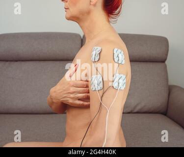 Frau in der Therapie mit Elektroden auf den Muskeln der Arme platziert, posttraumatische Rehabilitation, Behandlung Stockfoto