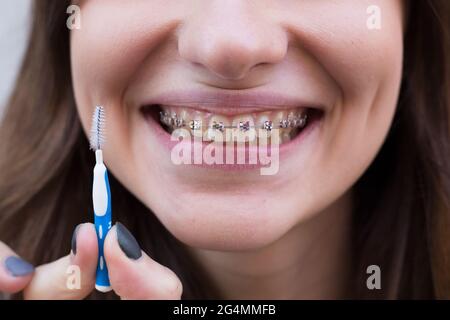 Schönes junges Mädchen mit Metallspangen für Zähne mit weißen Zähnen und Pinsel Stockfoto