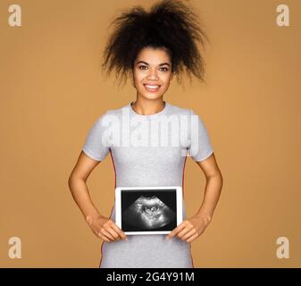 Mädchen zeigt das Röntgenbild des Ultraschallbabys. Foto von jungen Mädchen mit Tablet in den Händen auf beigem Hintergrund. Medizinisches Konzept Stockfoto