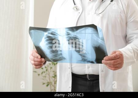Leitender Arzt mit Röntgenbild der Lunge in der Klinik Stockfoto