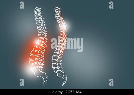 Von Hand gezeichnete Illustration der menschlichen Wirbelsäule auf dunkelgrauem Hintergrund. Medizin, Wissenschaftsset mit menschlichen Hauptorganen mit leerem Kopierraum für Text Stockfoto