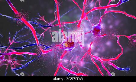 Zerstörung von Neuronen im dorsalen Striatum, Illustration Stockfoto