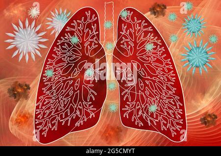 Schädigung des menschlichen Lungenorgans durch das 3D-Covid19-Virus. Fraktales Modell, Abstraktion Stockfoto