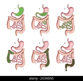 Menschliches Verdauungssystem. Verdauungsprozess Stockfoto