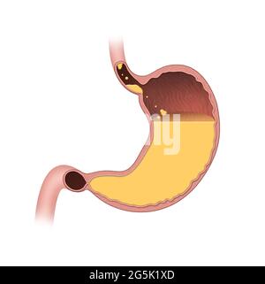 Der Magen ist ein muskulöses, hohles Organ. Im Verdauungssystem ist der Magen in die zweite Verdauungsphase nach dem Kauen involviert Stockfoto