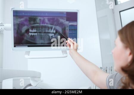 Zahnärztin, die in ihrer Klinik einen zahnärztlichen Röntgenscan untersucht Stockfoto