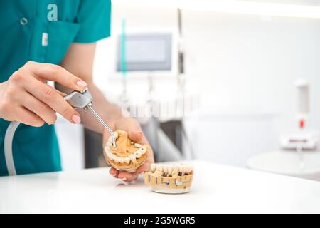 Die Hand des Zahnarztes hält ein künstliches Kiefermodell und zeigt die Zähne des Patienten. Behandlung in einer Zahnklinik. Nahaufnahme. Stockfoto