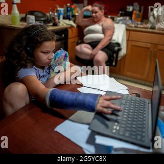 Aryanna Toched, 8, hält am Freitag, 28. Mai 2021 in Sacramento ihr Stofftier in der Hand, als sie ihren Computer mit ihrem gebrochenen Arm bedient. Ihre Mutter Kristi Philips macht eine Pause, während sie Kartoffelpüree und Schweinekoteletts zum Abendessen im Residence Inn by Marriott Hotel zubereitet, in dem sie sich jetzt aufhalten. Sie hofft, eines Tages in einem Haus zu leben, aber seit einem Jahr leben sie in Hotelzimmern und einem Wohnmobil, das sie besitzen, wenn sie nicht in der Lage sind, für Hotels zu bezahlen. Stockfoto