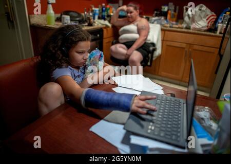 Sacramento, Kalifornien, USA. Mai 2021. Aryanna Toched, 8, hält ihr Stofftier in der Hand, als sie am Freitag in Sacramento ihren Computer mit ihrem gebrochenen Arm bedient. Ihre Mutter Kristi Philips macht eine Pause, während sie Kartoffelpüree und Schweinekoteletts zum Abendessen im Residence Inn by Marriott Hotel zubereitet, in dem sie sich jetzt aufhalten. Sie hofft, eines Tages in einem Haus zu leben, aber seit einem Jahr leben sie in Hotelzimmern und einem Wohnmobil, das sie besitzen, wenn sie nicht in der Lage sind, für Hotels zu bezahlen. (Bild: © Renee C. Byer/The Sacramento Bee/ZUMA Press Wire) Stockfoto