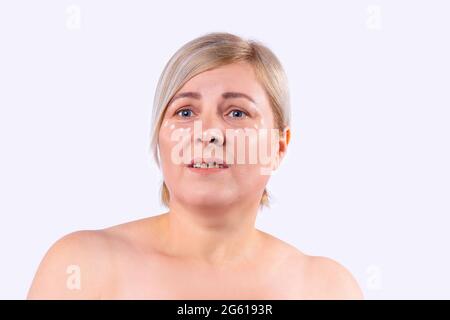 Schöne Frau mit sauberer frischer Haut geht durch die kosmetische Verfahren mit Punkten aus der Creme auf dem Gesicht. Stockfoto
