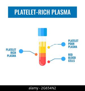Thrombozytenreiches Plasma, Abbildung Stockfoto