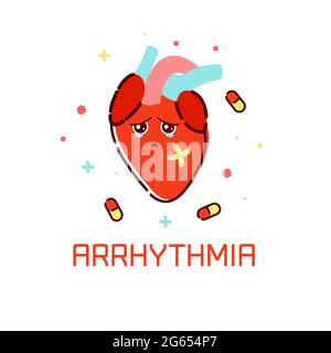 Herzrhythmusstörungen, konzeptionelle Illustration Stockfoto