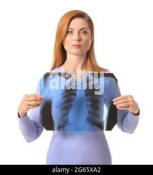 Frau mit Röntgenbild der Lunge auf weißem Hintergrund Stockfoto