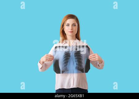 Frau mit Röntgenbild der Lunge auf farbigem Hintergrund Stockfoto
