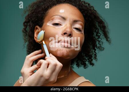 Junge Frau mit Vitiligo tun Gesichtsmassage mit Gua Sha Roller isoliert über blaue Wand Stockfoto