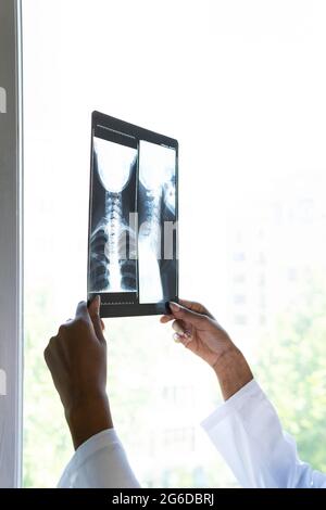 Crop schwarze weibliche Sanitäter in der Nähe des Fensters stehen und untersuchen Röntgen-Scan während der Arbeit in der Klinik Stockfoto