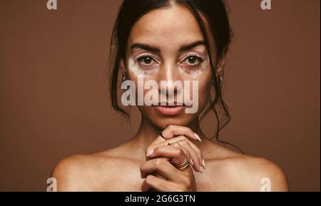 Nahaufnahme einer Frau mit Vitiligo-Störung um ihre Augen. Schöne Frau mit Hautstörung auf braunem Hintergrund. Stockfoto