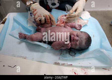 Maracaibo- Venezuela-19-06-2015- Maternitty Castillo Plaza in Venezuela. Die Geburt eines Jungen durch ein Neugeborenes wird überprüft. © JOSE ISAAC BULA URRUTIA Stockfoto