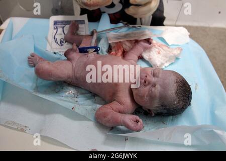 Maracaibo- Venezuela-19-06-2015- Mutterschaft Castillo Plaza in Venezuela. Die Geburt eines Jungen durch ein Neugeborenes wird überprüft. © JOSE ISAAC BULA URRUTIA Stockfoto
