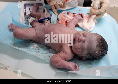 Maracaibo- Venezuela-19-06-2015- Mutterschaft Castillo Plaza in Venezuela. Die Geburt eines Jungen durch ein Neugeborenes wird überprüft. © JOSE ISAAC BULA URRUTIA Stockfoto
