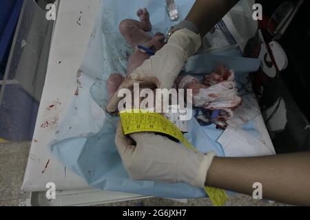 Maracaibo- Venezuela-19-06-2015- Maternitty Castillo Plaza in Venezuela. Die Geburt eines Jungen durch ein Neugeborenes wird überprüft. © JOSE ISAAC BULA URRUTIA Stockfoto