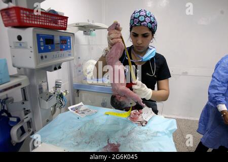 Maracaibo- Venezuela-19-06-2015- Mutterschaft Castillo Plaza in Venezuela. Die Geburt eines Jungen durch ein Neugeborenes wird mit Maßband überprüft. © JOSE Stockfoto