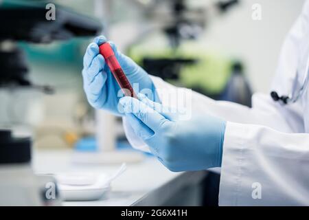 Wissenschaftler im biologischen Labor hält Blutprobe in Hand mit Blaue Handschuhe Stockfoto