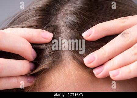 Nahaufnahme einer Frau, die ihre Haare und ihre Haare, Haarausfall am Haaransatz oder trockenes Kopfhautproblem untersucht. Stockfoto