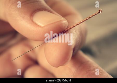 Hände eines Arztes, der eine Akupunkturnadel mit Kupferhandhabung hält. Chinesische alternative Medizin. Behandlung von Krankheiten mit Nadeln. Stockfoto