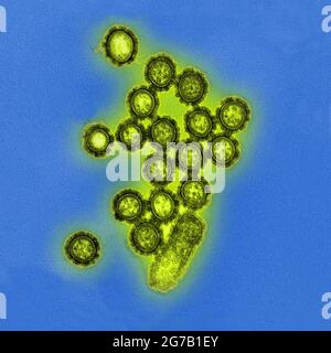 Diese digital kolorierte, mikroskopische Transmissionselektronenaufnahme (TEM) des US National Institute of Allergy and Infectious Diseases (NIAID) zeigt eine Anzahl von H1N1-Influenza-Viruspartikeln. Oberflächenproteine, die sich auf der Oberfläche der Viruspartikel befinden, sind schwarz dargestellt. Eine optimierte und verbesserte Version eines Bildes, das vom US National Institute of Allergy and Infectious Diseases produziert wurde / Kredit: NIAID Stockfoto