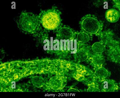 Dieses vom US National Institute of Allergy and Infectious Diseases (NIAID) produzierte, hoch vergrößerte, digital kolorierte Transmissionselektronenmikroskopische (TEM)-Bild zeigt ultrastrukturelle Details, die von einer Reihe sphärischer Coronavirus-Virionen (MERS-CoV) des Middle East Respiratory Syndrome gezeigt werden. Eine optimierte und verbesserte Version eines Bildes, das vom US National Institute of Allergy and Infectious Diseases produziert wurde / Kredit: NIAID Stockfoto