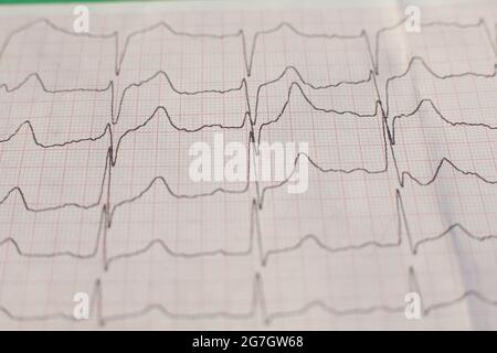Gedrucktes Kardiogramm auf grünem Hintergrund Stockfoto