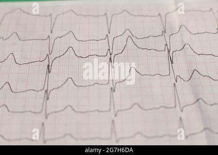 Gedrucktes Kardiogramm auf grünem Hintergrund Stockfoto