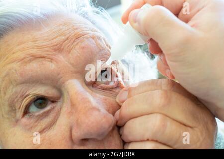 Der Arzt trägt Tropfen auf, um das Auge der alten Frau mit Feuchtigkeit zu versorgen. Medizin- und Gesundheitskonzept Stockfoto