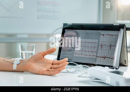 Hand mit Sensoren für die Herzfrequenzmessung Stockfoto