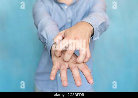 Mann juckende Hände auf blauem Hintergrund. Krätze an den Händen Stockfoto