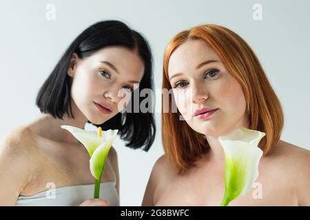 Plus Größe und Frau mit Vitiligo hält Calla Lilien isoliert auf grau Stockfoto