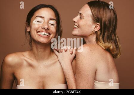 Porträt zweier glücklicher Frauen mit Hautpigmentierung vor braunem Hintergrund. Junge Frauen mit Vitiligo und Sommersprossen in fröhlicher Stimmung. Stockfoto