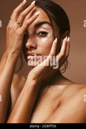 Nahaufnahme einer jungen Frau mit Vitiligo, die ihr Gesicht mit der Hand bedeckt. Mode Bild der schönen Frau mit Vitiligo Stockfoto