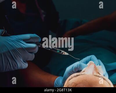 Chirurg Arzt, der Rhinoplastik-Operation im Operationssaal im modernen Krankenhaus - Fokus auf den Kopf des Patienten Stockfoto